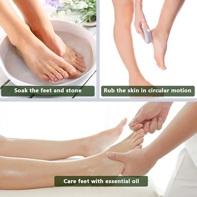 AM7631 Natural Oval Pumice Stone Exfoliator for Foot Care and Dead Skin Callus Removal - Image 6