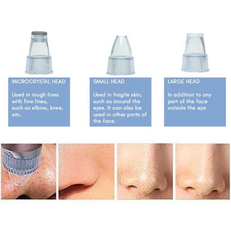 0351 -4 In 1 Blackhead Whitehead Extractor Remover Device Acne Pimple Pore Cleaner (Vacuum Suction Tool) - Image 5