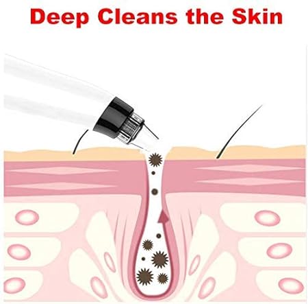 0351 -4 In 1 Blackhead Whitehead Extractor Remover Device Acne Pimple Pore Cleaner (Vacuum Suction Tool) - Image 6